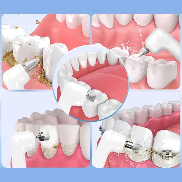 Полировщик зубов электрический WD-MY-001