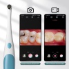 Видеоскоп для полости рта ZCF AN109, 1920*1440, каб USB-C + Lightning, белый