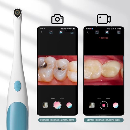Видеоскоп для полости рта ZCF AN109, 1920*1440, каб USB-C + Lightning, белый