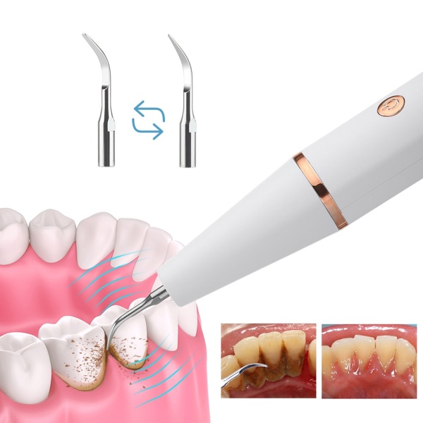 Скалер для удаления зубного камня Household Tooth Cleaner