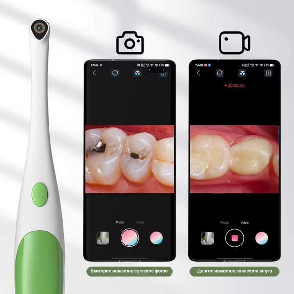 Видеоскоп для полости рта ZCF AN109, 2MP, каб USB-A + USB-C + microUSB, белый